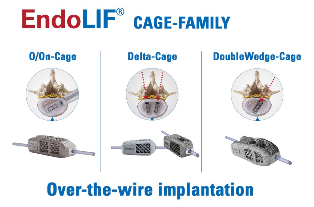 joimax cage family EndoLIF