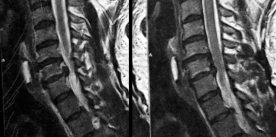 CESSYS-ventral-mri