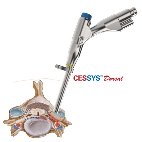 CESSYS-Dorsal-Access-Zugang