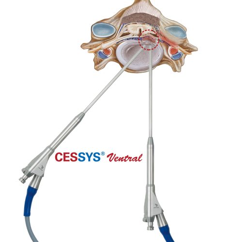 CESSYS-Ventral-Access-Zugang