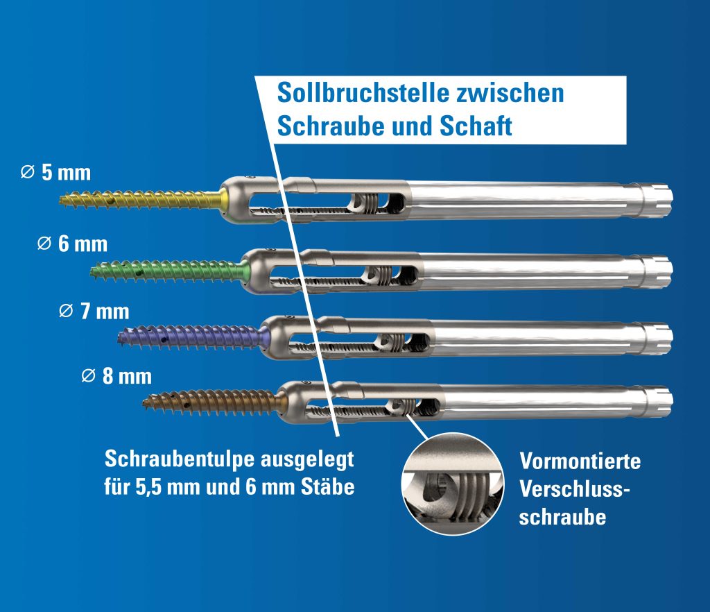 Endoskopische-stabilisierung-optionen-joimax-product-percusys-schrauben-mit-einzigartigem-design-scaled