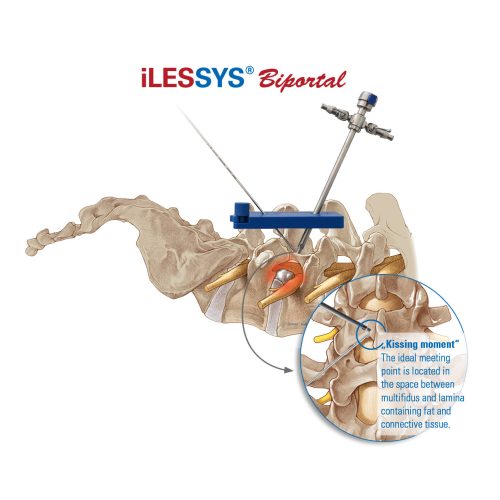 iLESSYS-Biportal-Access